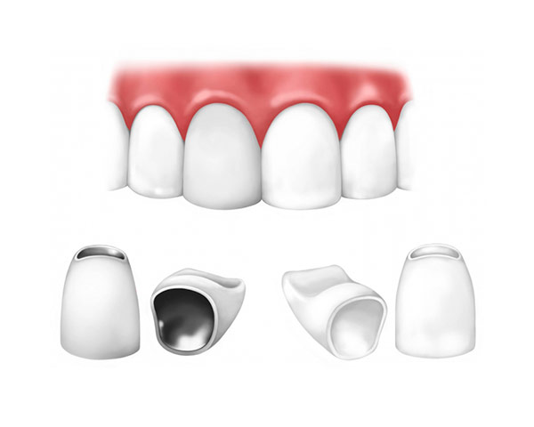 Коронки и протезы